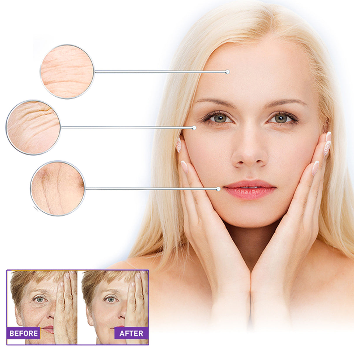 EELHOE Facial Wrinkle Patch, Droop Decree Line Lift Facial Skin Tightens Mouth Line Cheek Patch